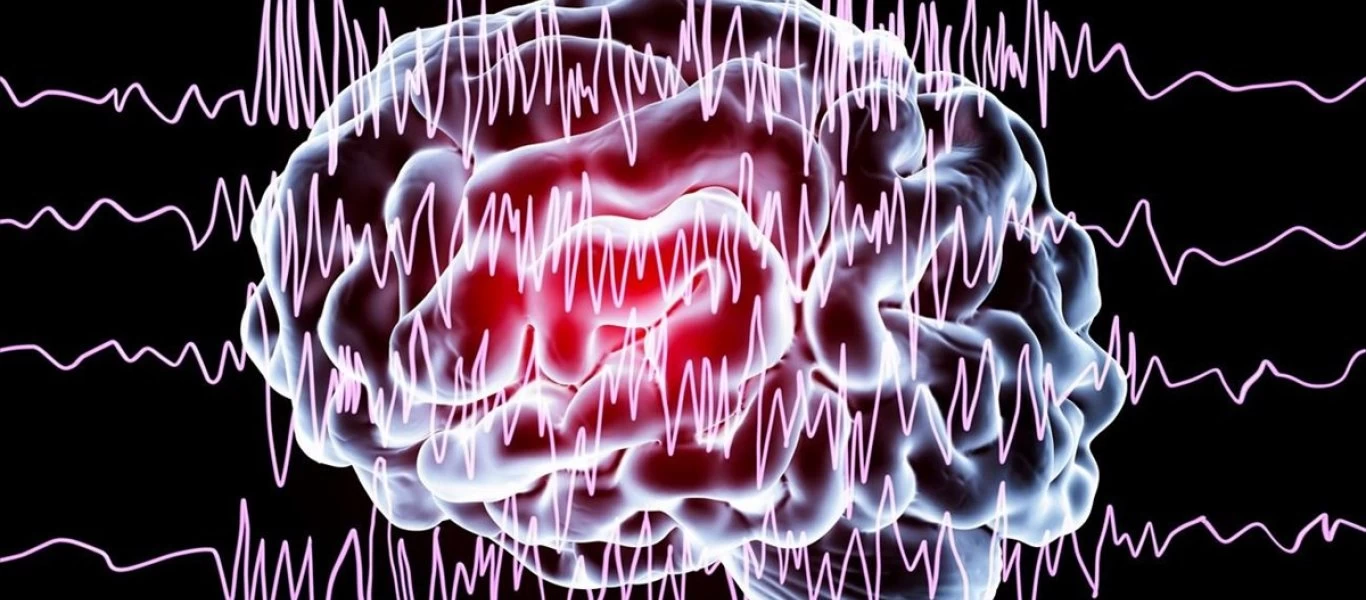 Επιληψία: Τα 9+1 πράγματα που πρέπει να γνωρίζετε